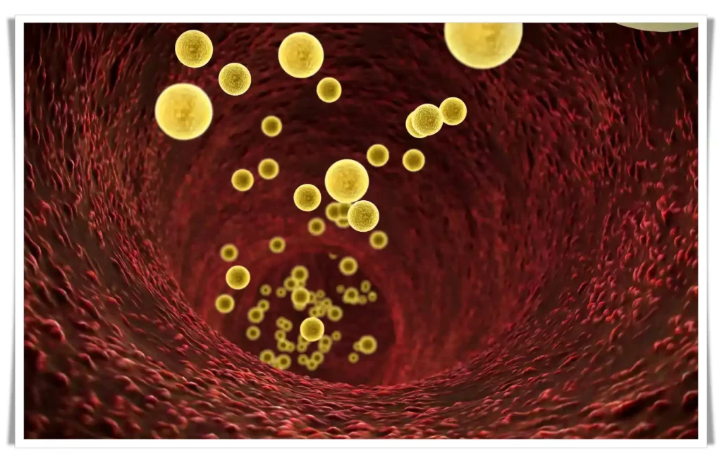 What Diseases Can Cholesterol Occur And What Are The Risk Factors