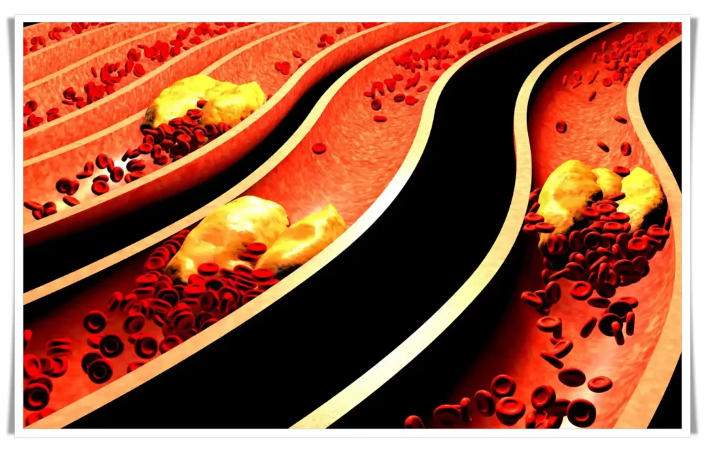 Cholesterol - What It Is And What Role It Plays