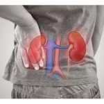 Kidney Detoxification. The Top 5 Most Important Reasons.