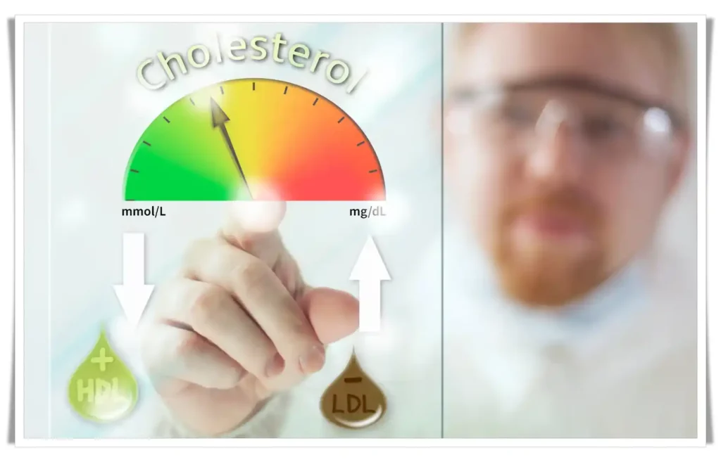 cholesterol levels